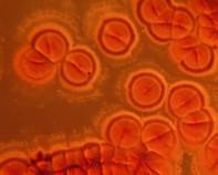 streptomyces colonies streptomyces colonies